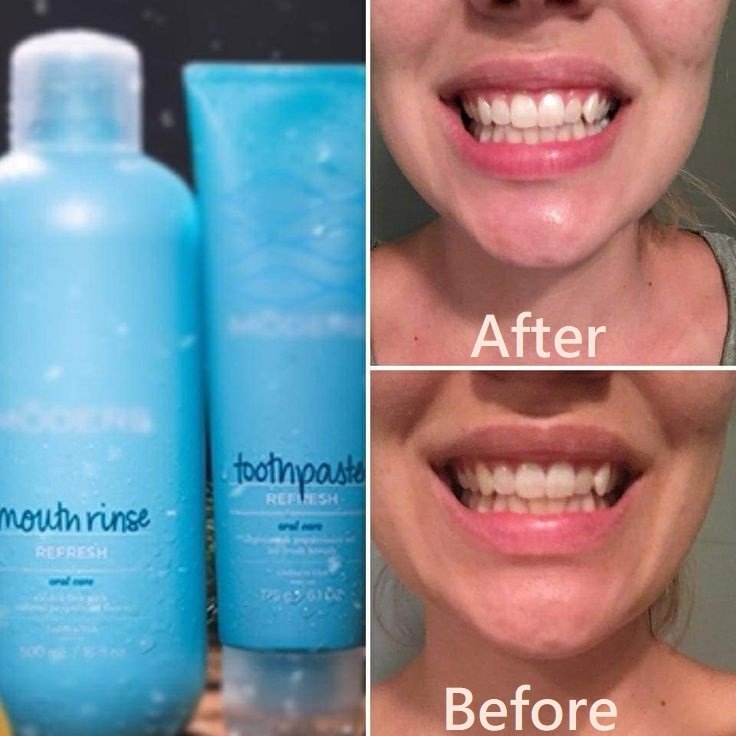 modere toothpaste fluoride free - Shaklee NZ Shaklee Toothpaste NZ — SLS-free natural oral care 175g