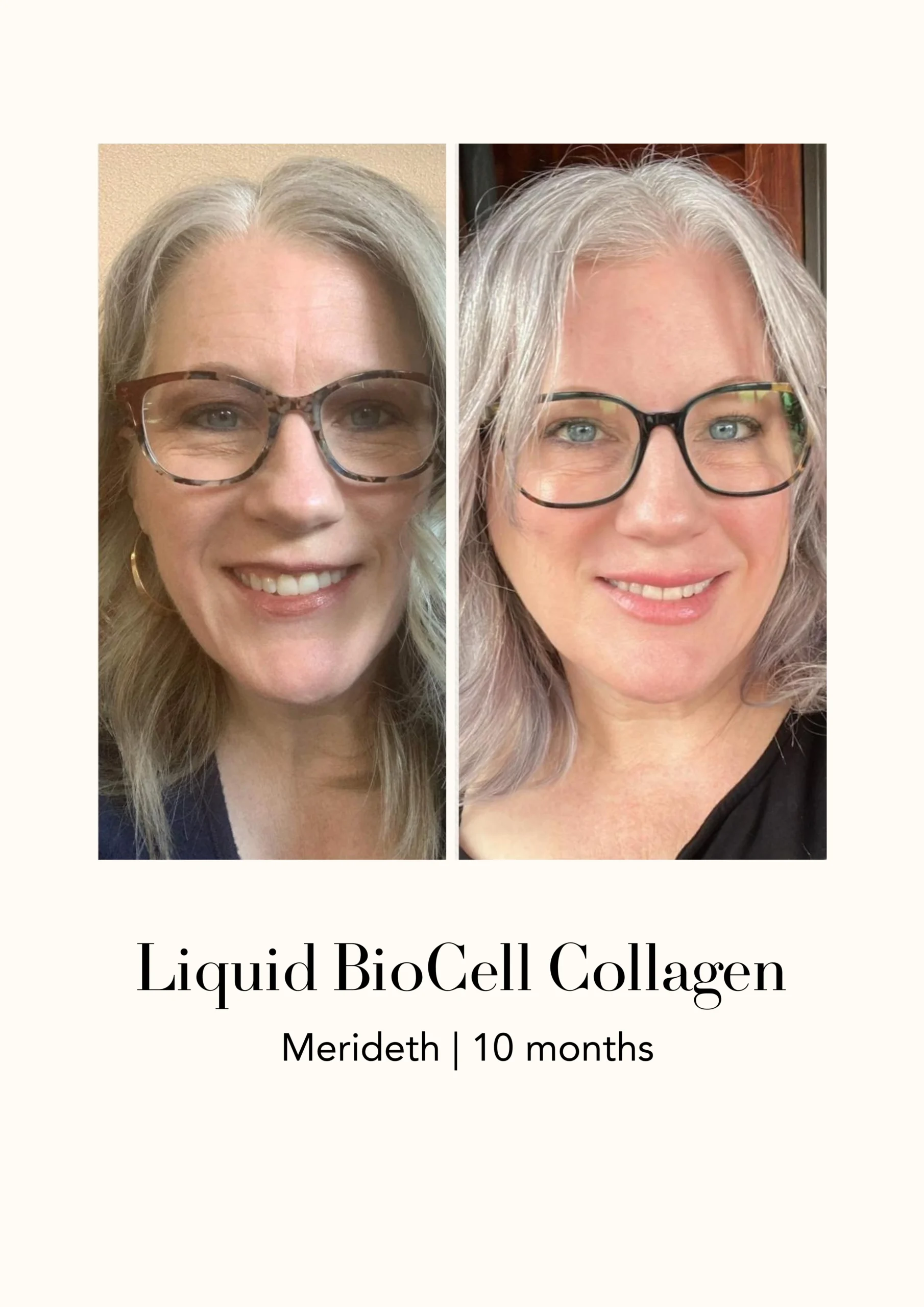 Modere Liquid BioCell Collagen Before After 1 1 - Shaklee NZ Modere Liquid BioCell NZ — collagen supplement New Zealand