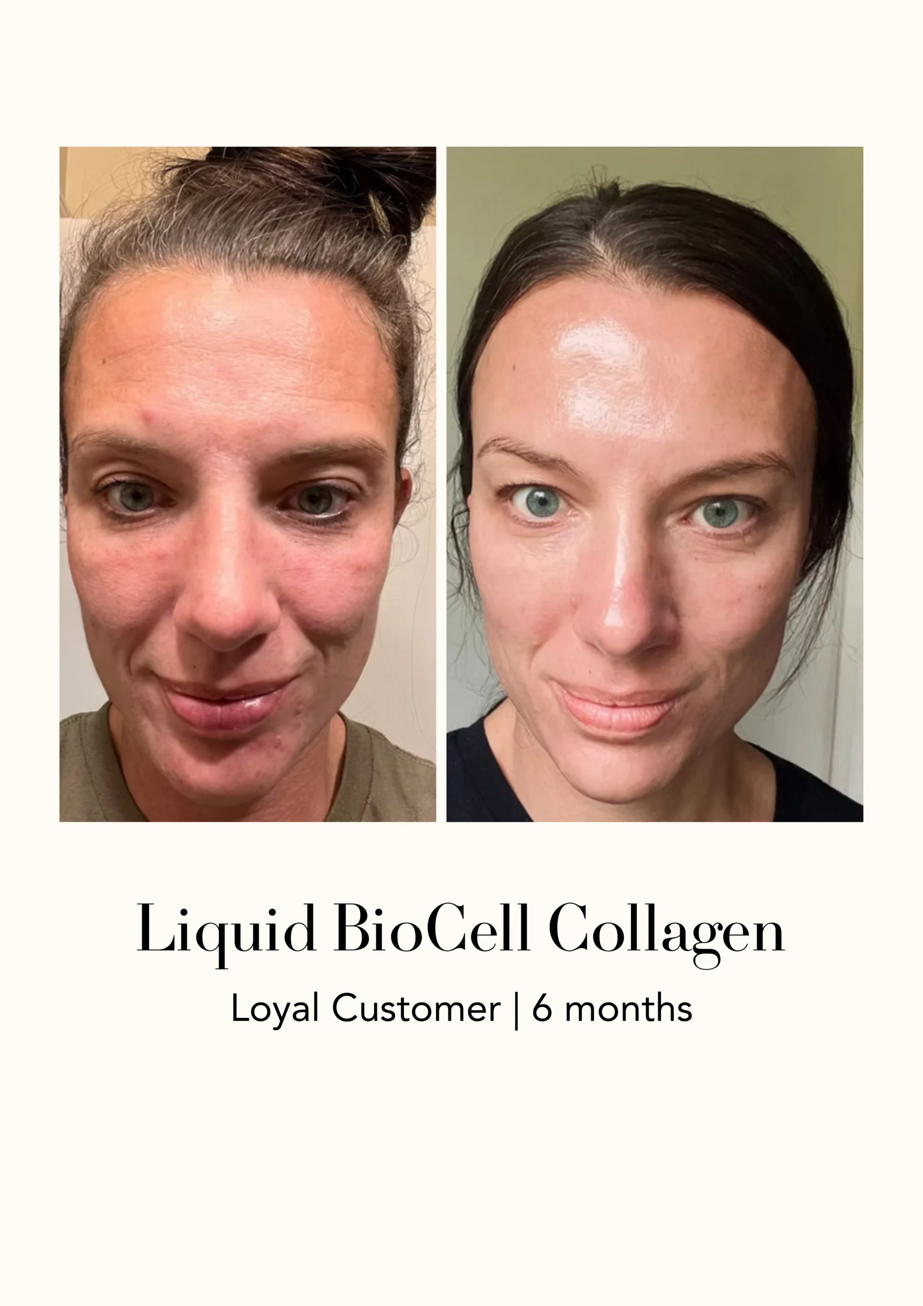 Modere Liquid BioCell Collagen Before After 1 2 - Shaklee NZ Modere Liquid BioCell NZ — collagen supplement New Zealand