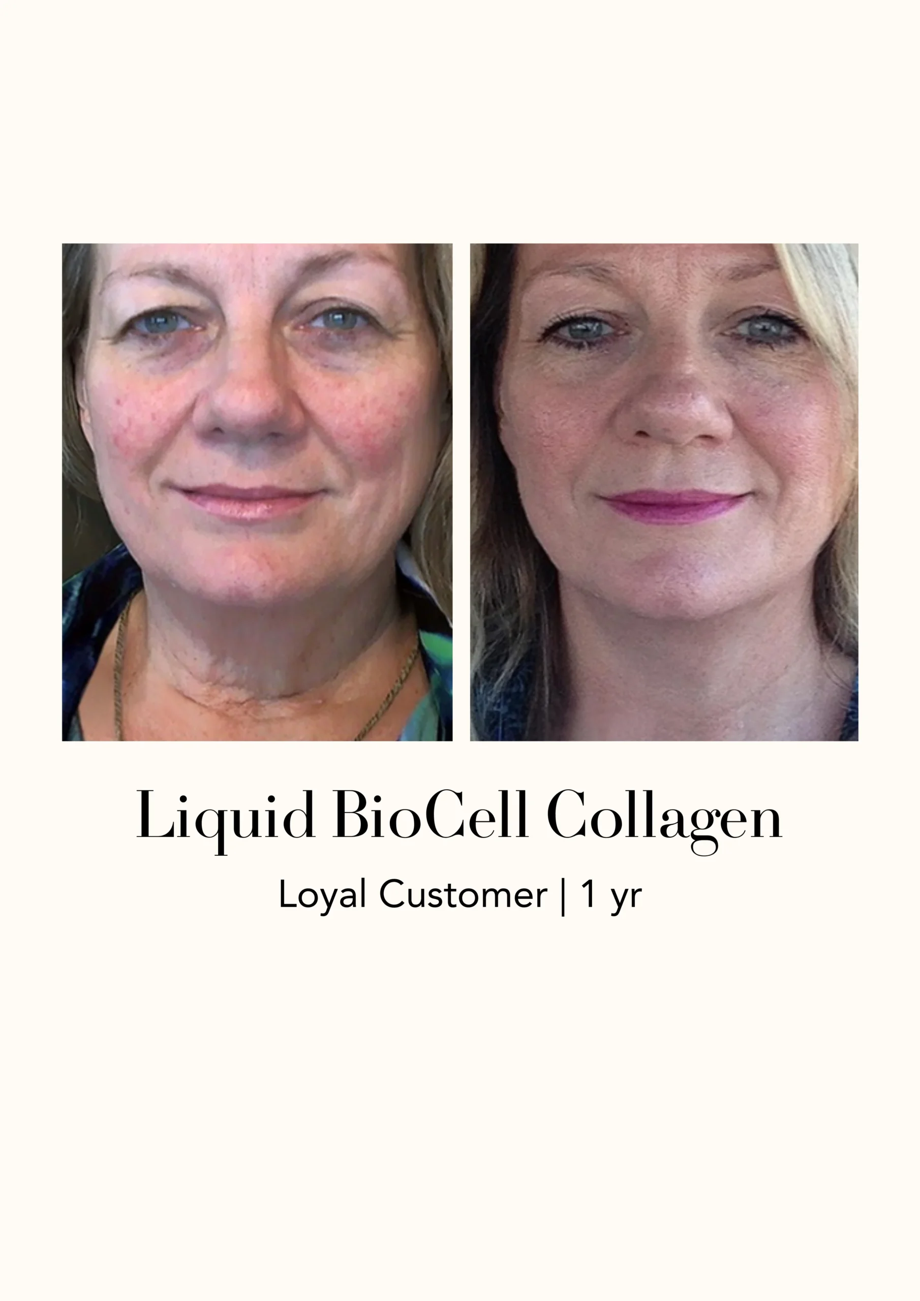 Modere Liquid BioCell Collagen Before After 1 3 - Shaklee NZ Modere Liquid BioCell NZ — collagen supplement New Zealand
