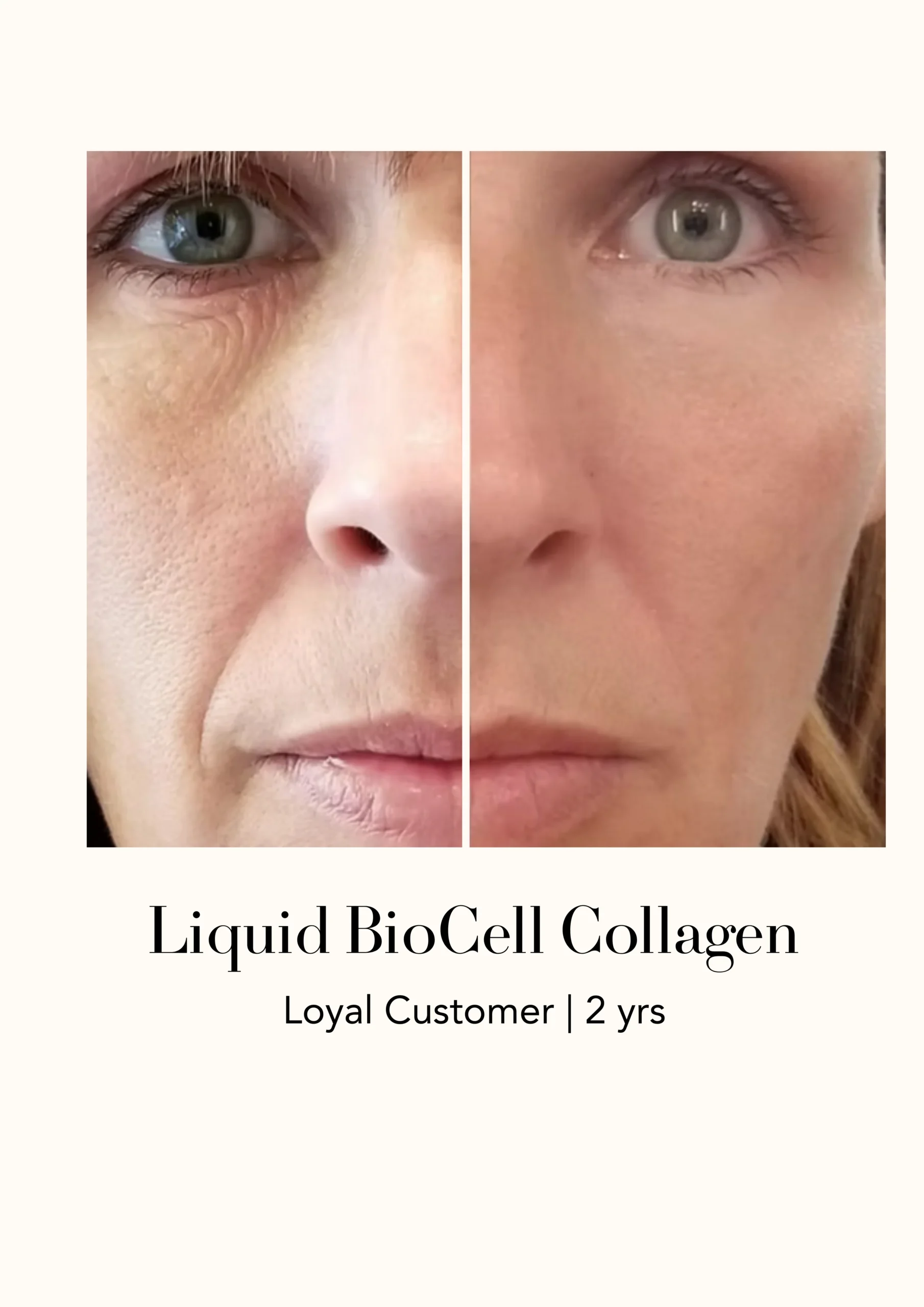 Modere Liquid BioCell Collagen Before After 1 4 - Shaklee NZ Modere Liquid BioCell NZ — collagen supplement New Zealand