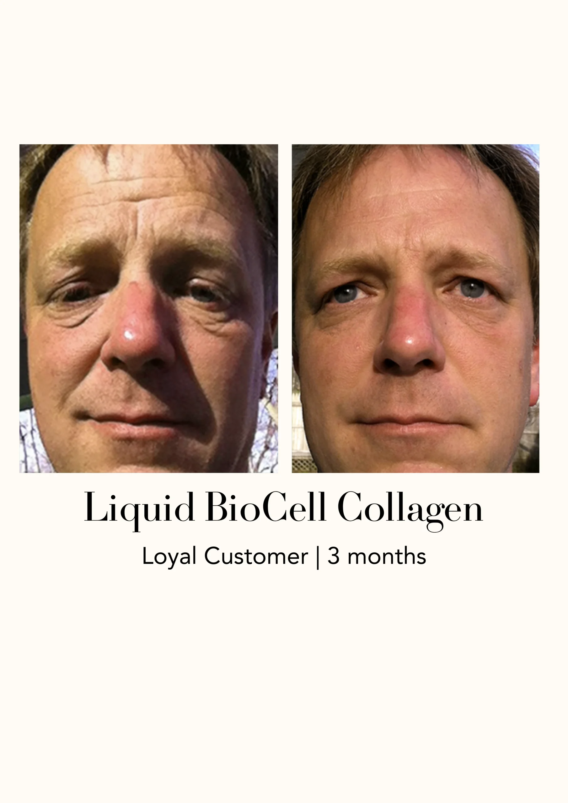 Modere Liquid BioCell Collagen Before After 15 - Shaklee NZ Modere Liquid BioCell NZ — collagen supplement New Zealand