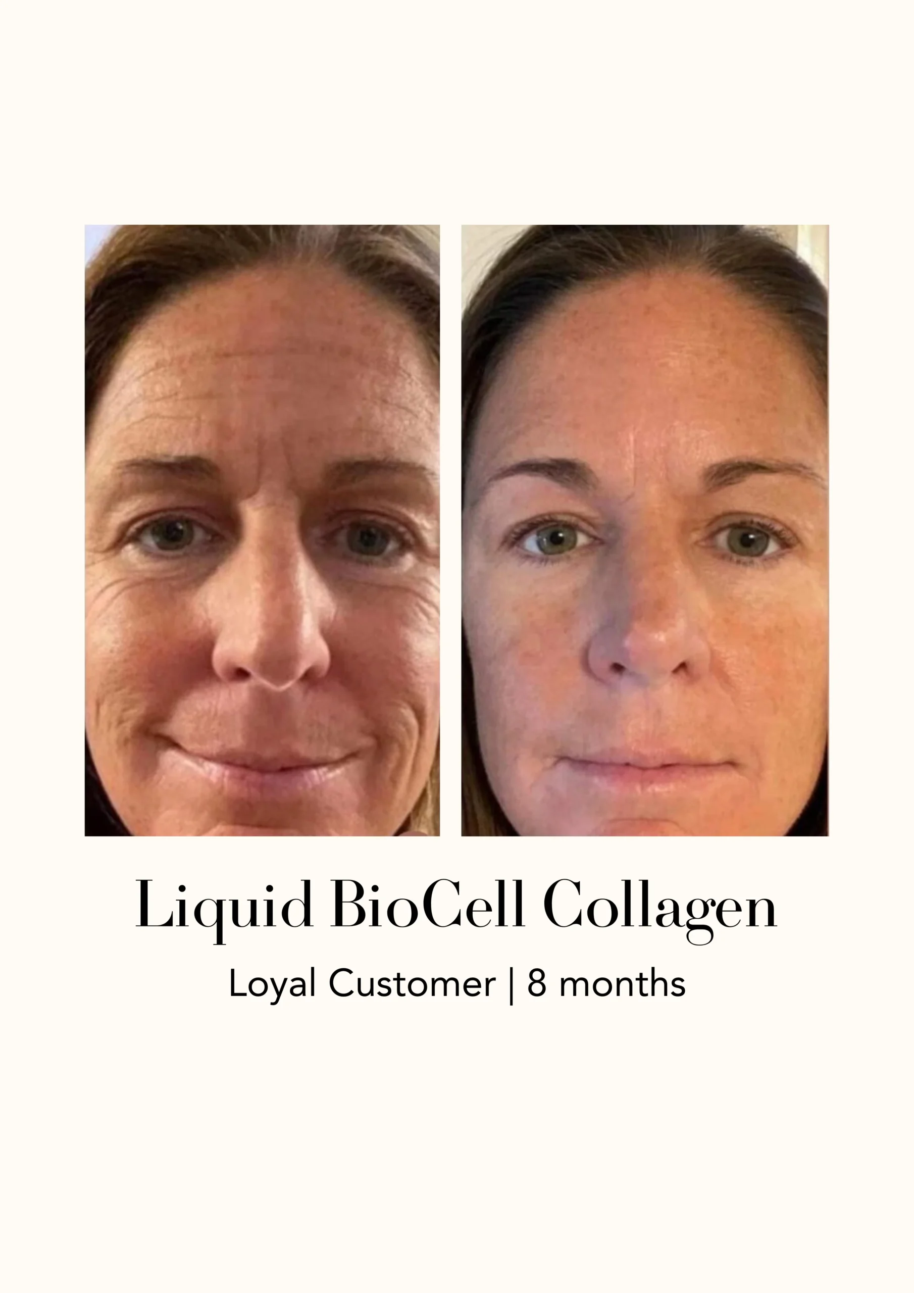 Modere Liquid BioCell Collagen Before After 33 - Shaklee NZ Modere Liquid BioCell NZ — collagen supplement New Zealand