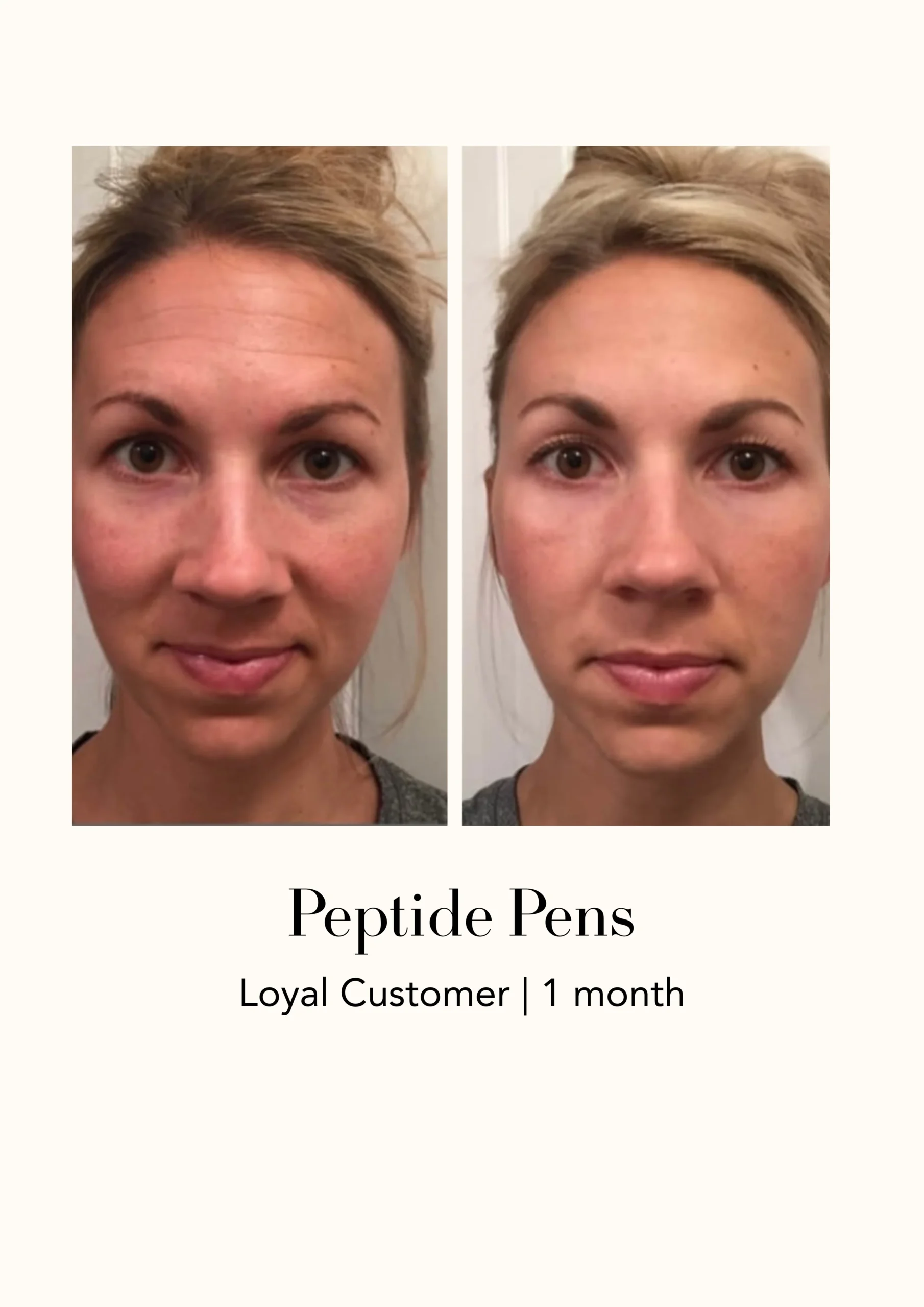 Peptide Wand Shaklee Before After - Shaklee NZ Peptide Wand Shaklee Before After — New Zealand